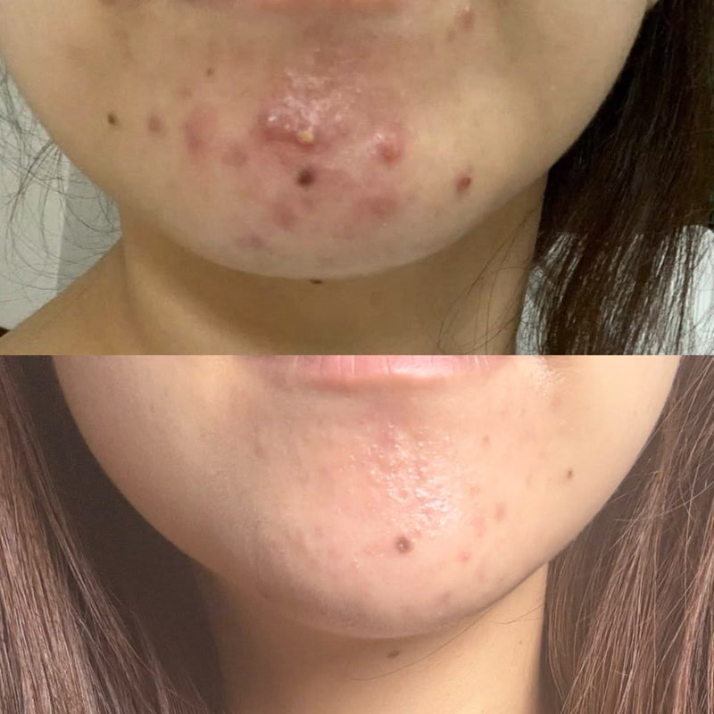 Chloé, 19 ans