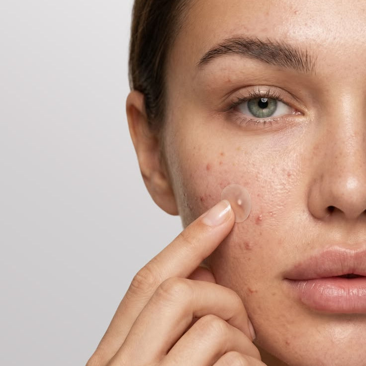 Patchs anti-imperfections invisibles – lot de 360