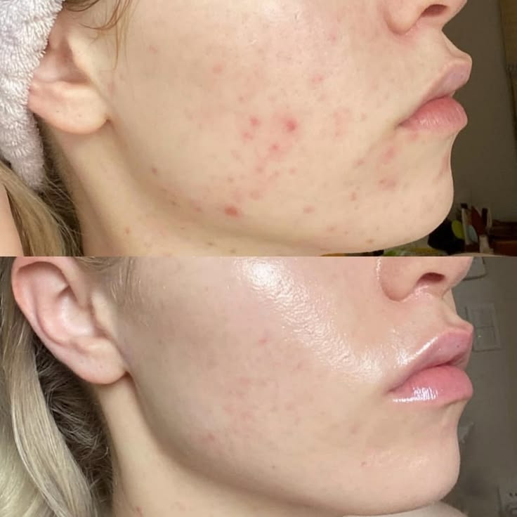 Maëlle, 34 ans